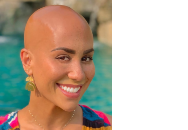 Women with bald head 